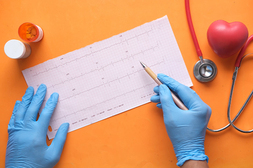 Why Sleep Apnea Can Go Undiagnosed in AF